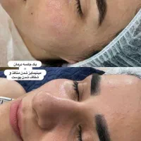 فیشیال پاکسازی حرفه ای با جدید ترین متد روز دنیا|خدمات آرایشگری و زیبایی|اهواز, کیانپارس |دیوار