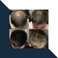 تار موهات ضخیم میشه