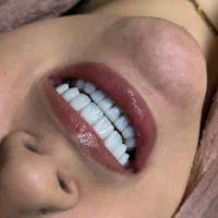 زیبایی دندان با قیمت مناسب و کیفیت بالا