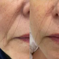 جوانسازی بسیار قوی ، برند اسپانیا ،|آرایشی، بهداشتی، درمانی|ری, امین آباد|دیوار