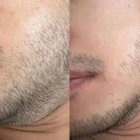 راحله کاملا گیاهی و تضمینی