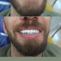 خدمات دندانپزشکی و دندانسازی با ضمانت ، اقساط