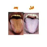 مشاوره رایگان زبان