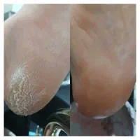 پدیکور و کف سابی