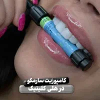 دندانپزشکی کامپوزیت فکی ۸ میلیون با ضمانت ده ساله