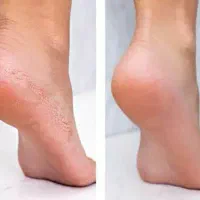 آموزش رنگ لایت کفسابی پا میکاپ فشیال کراتین|خدمات آرایشگری و زیبایی|مشهد, صیاد شیرازی|دیوار