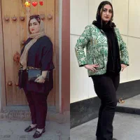 لاغری با بوتاکس معده|خدمات آرایشگری و زیبایی|تهران, جردن|دیوار