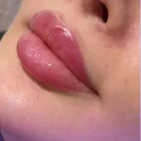 کلینیک تخصصی لیزر مو تزریق ژل لب فیلر بوتاکس مزو