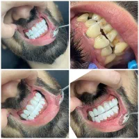 دندانپزشکی وزیبایی|خدمات آرایشگری و زیبایی|تهران, تهران پارس|دیوار