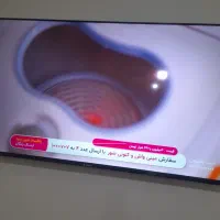 مینی واش تز