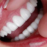 فقط با  پنج میلیون کامپوزیت کن|خدمات آرایشگری و زیبایی|تهران, سهروردی|دیوار