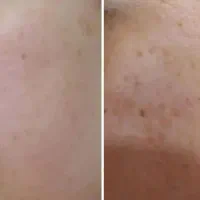 پاکسازی صورت