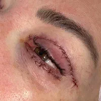 عمل بینی با هزینه بیمارستان ۴۵م (تمام جراحی ها)|خدمات آرایشگری و زیبایی|تهران, سعادت‌آباد|دیوار