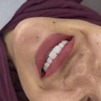 جشنواره ویژه ونیر کامپوزیت|خدمات زیبایی و سلامت|قم, زنبیل آباد|دیوار