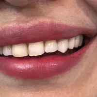 بیماریاب دندانپزشکی