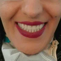دندان مصنوعی دندانسازی بامجوز رسمی و ۵۰درصدتخفیف|پزشکی|مشهد, پایین خیابان|دیوار