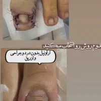 درمان بیماری ناخن ساختمان پزشکان رز پیروزی ۳۸|خدمات آرایشگری و زیبایی|مشهد, چهارچشمه|دیوار