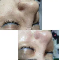 پاکسازی وفیشال|خدمات آرایشگری و زیبایی|شهریار, شهریار|دیوار