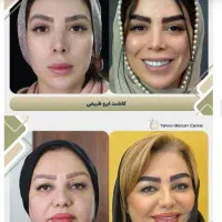 تور جراحی زیبایی بانوان|خدمات آرایشگری و زیبایی|ساری, |دیوار