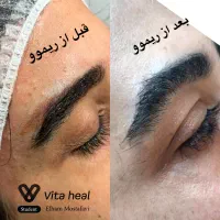 جشنواره یلدایی ریموو تخصصی تتو ابرو چشم و لب|خدمات آرایشگری و زیبایی|شیراز, تندگویان|دیوار