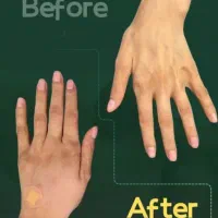 تخفیفات فیلر بادی ،بوتاکس،کانتورینگ توسط پزشک|خدمات آرایشگری و زیبایی|کرج, گوهردشت|دیوار