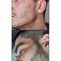 رویش مجدد‌ و تضمینی