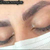 تخفیف بلک فرایدی میکروبلیدینگ فیبروز