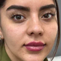 بلفاروپلاستی ،سانترال،دایرکت ابرو،کاشت vipجشنواره|خدمات آرایشگری و زیبایی|تهران, تجریش|دیوار