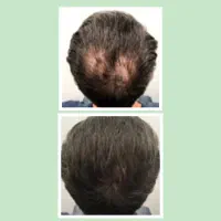 پک ویژه وارداتی (فقط تعداد محدود)
