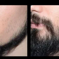 روغن برای پرپشتی ریش نزد ماست