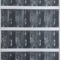 متخصص کمر درد،سیاتیک، دیسک کمر،تنگی کانال،ابدرمانی|خدمات آرایشگری و زیبایی|مشهد, رضاشهر|دیوار