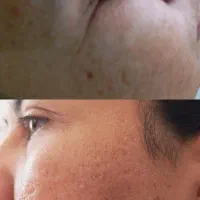 پاکسازی و فیشال تخصصی