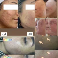 زیبایی|خدمات آرایشگری و زیبایی|تربت جام, المهدی|دیوار