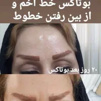 آموزش و خدمات ژل و بوتاکس|خدمات آرایشگری و زیبایی|زابل, |دیوار