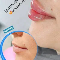 ۴۵۰،۰۰۰ ت هدیه باشگاه مشتریان یاناومایا (فیلر لب)|خدمات آرایشگری و زیبایی|دزفول, |دیوار