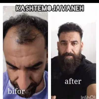 جشنواره یلدایی کاشت موشیرازی از۱۳تومن|خدمات آرایشگری و زیبایی|تهران, صد دستگاه|دیوار