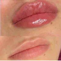 تخفیف ویژه دکتر شکری