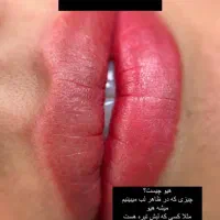 انجام شیدینگ لب فقط با هزینه مواد