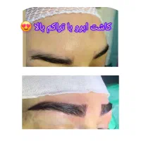 زیبایی ،پوست ،جراحی|خدمات آرایشگری و زیبایی|سهند, |دیوار