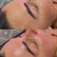 خروج لک و کک مک جای جوش با درمان تلفیقی|خدمات آرایشگری و زیبایی|سبزوار, کاشفی شمالی (دادگستری)|دیوار