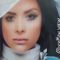 لنز OXYGEN VIEW کره یک ساله ضدحساسیت|آرایشی، بهداشتی، درمانی|حبیب آباد, |دیوار