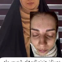 خداحافظی با ریزش مو و ابرو|خدمات آرایشگری و زیبایی|شیراز, قصرالدشت|دیوار