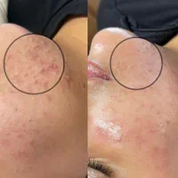 آموزش صفرتاصد پاکسازی/آموزش فیشال|خدمات آموزشی|شیراز, معالیآباد|دیوار