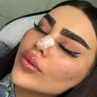 به چند نفر مدل تزریق ژل و بوتاکس نیازمندیم|خدمات آرایشگری و زیبایی|ارومیه, |دیوار