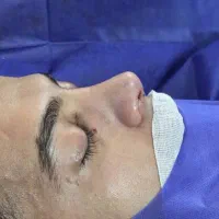 عمل های بادی وزیبایی لیپو ماتیک