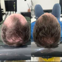 موهات دوباره جون می‌گیرن