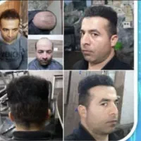 جشنواره پاییزی،کاشت مو وابرو