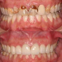 ویژه کارمندان پرداخت آسان چک صیادی تخفیف ویژه|خدمات آرایشگری و زیبایی|قم, زنبیل آباد|دیوار