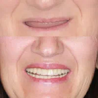 اقساط دندانپزشکی بدون پرداخت پول کلیه خدمات|خدمات آرایشگری و زیبایی|اصفهان, دشتستان|دیوار