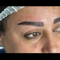 آموزش تخصصی فیلروبوتاکس